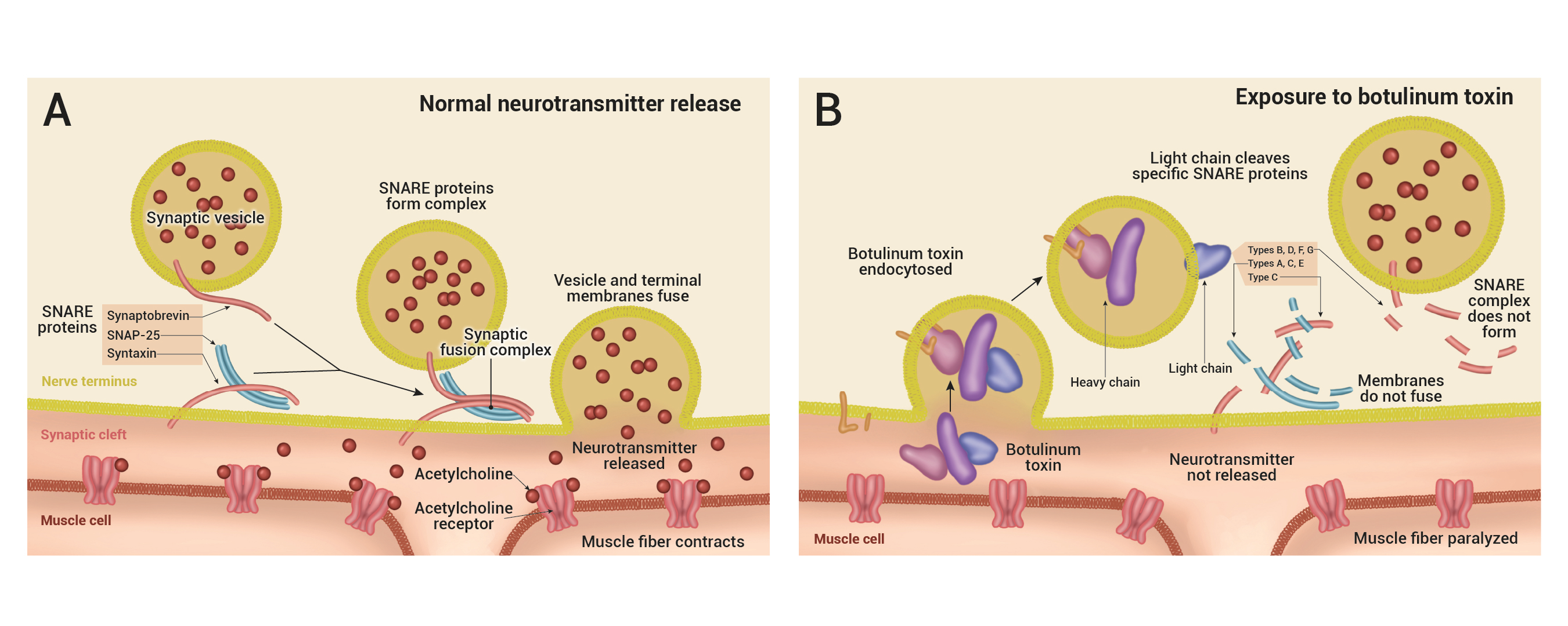 Two-panel diagram of the neuromuscular junction. Panel A, normal release: a synaptic vesicle uses SNARE proteins (synaptobrevin, SNAP-25, syntaxin) to fuse with the nerve terminal and release acetylcholine, which reaches receptors on the muscle and makes the fiber contract. Panel B, exposure to botulinum toxin: the toxin is taken into the terminal and its light chain cleaves specific SNARE proteins, so the SNARE complex cannot form, the membranes do not fuse, acetylcholine is not released, and the muscle fiber is paralyzed.